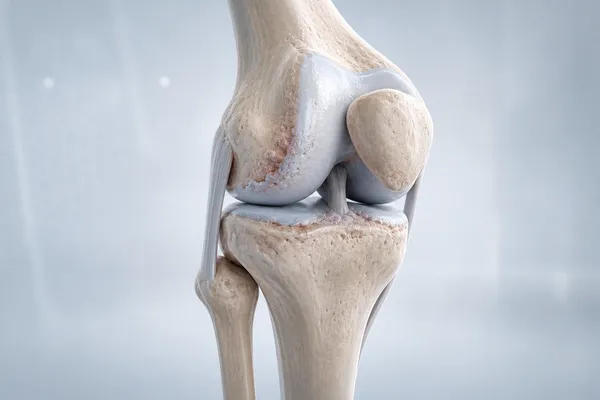Diz Kireçlenmesi (Diz Osteoartriti)